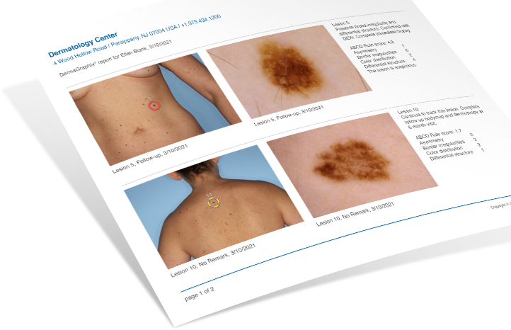 A printable lesion report generated by DermaGraphix