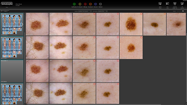 Dermoscopic images organized by DermaGraphix for efficient review