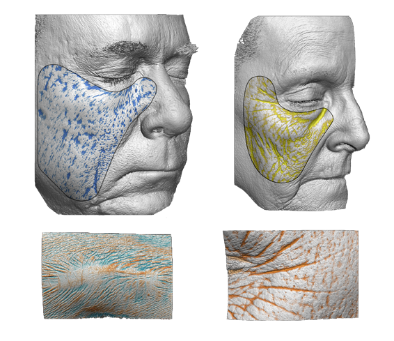 Primos CR's 3D mapping that visualizes height and volume of a person's skin in color