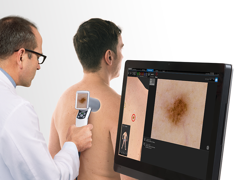 a medical professional using Canfield's D200evo to look at an individual lesion