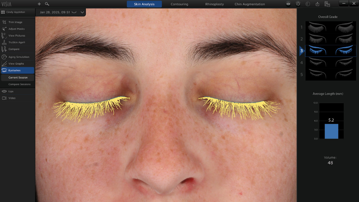 AI Driven Eyelash Analysis