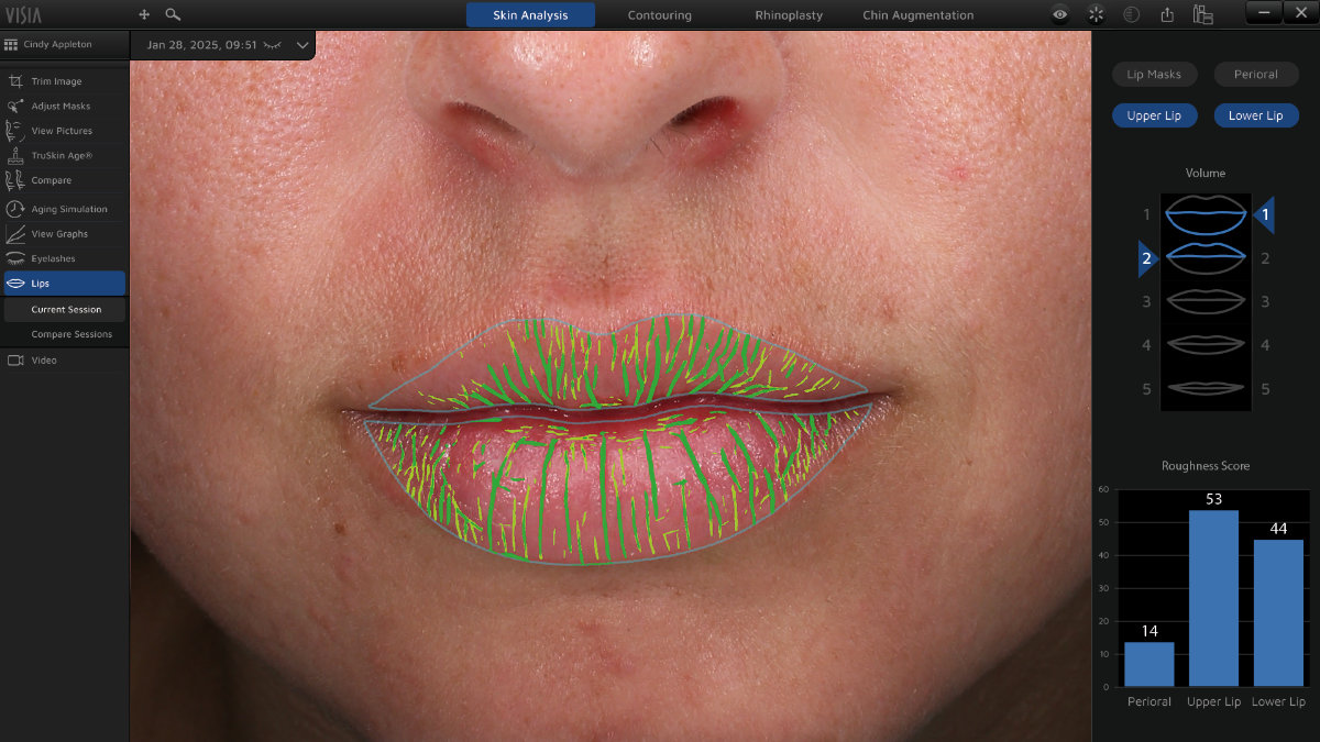 AI Driven Lip Assessment