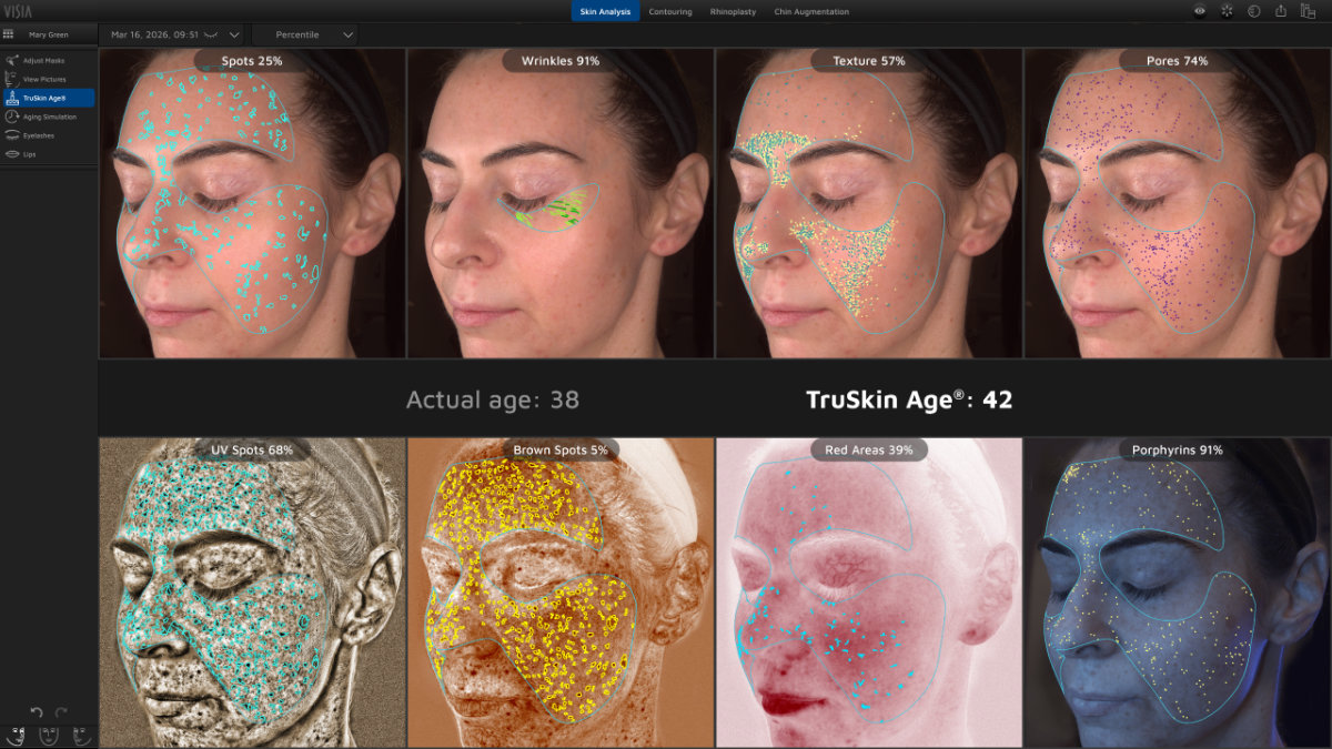 Tru Skin Age