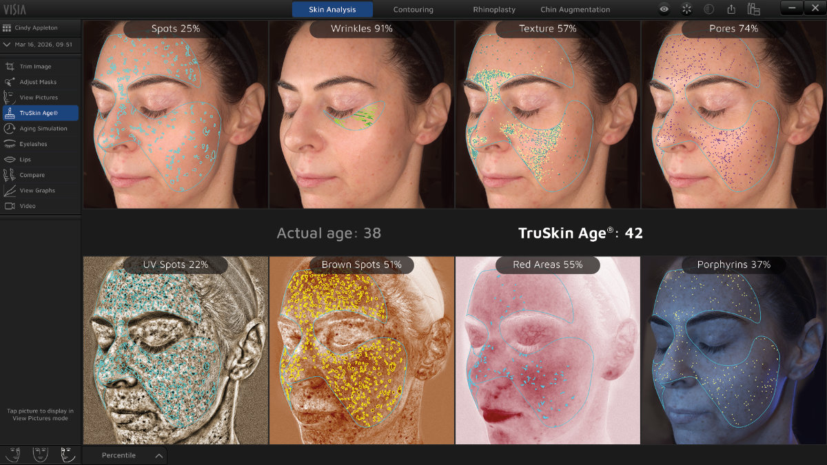 Tru Skin Age